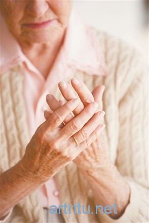 Симптомы и признаки артрита