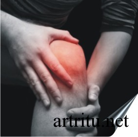 Симптомы коленного артрита