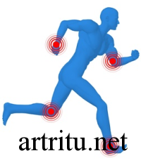 arthritis-gymnastics