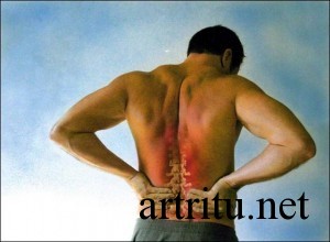 Разница между артрозом и артритом