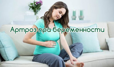 Артроз при беременности
