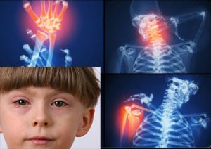Причины артрита у ребенка