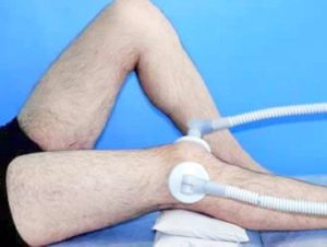 Физиотерапия при хондрозе коленного сустава