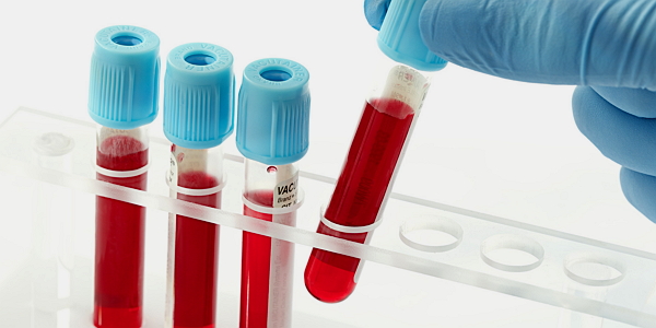 Лабораторный анализ крови