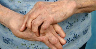 Эрозивный артрит кистей рук