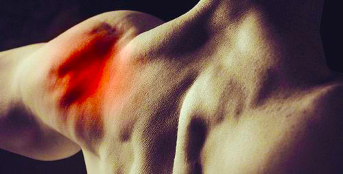 Артрит плечевого сустава – симптомы