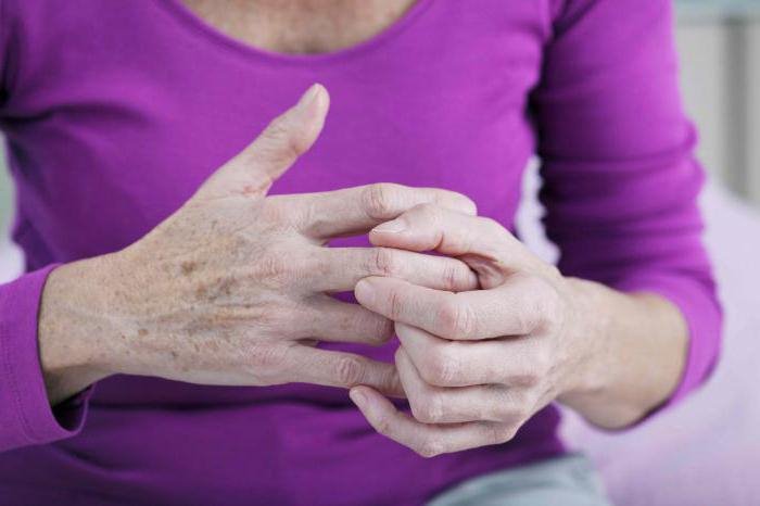 Деформирующий остеоартроз кистей рук