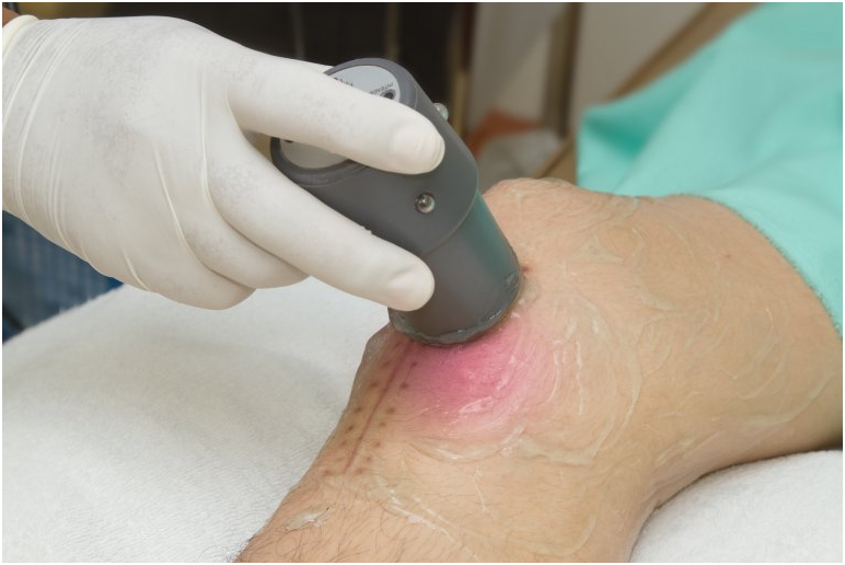 Как проводится процедура лечения лазером коленного сустава