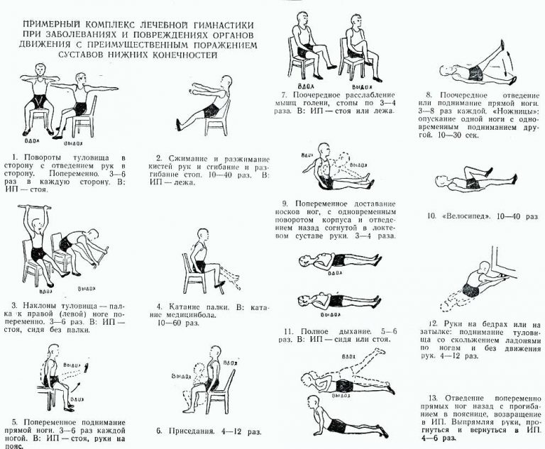 упражнения при артрозе коленного сустава