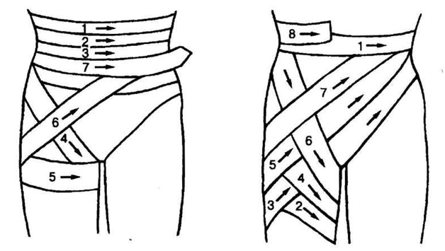 Схема наложения задней и передней нисходящей повязок
