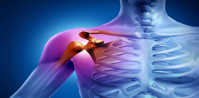 Артроз плечевого сустава — симптомы и лечение