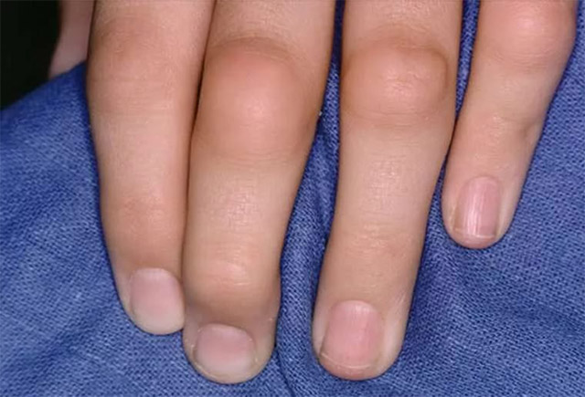 Причины ноющих болей в суставах рук