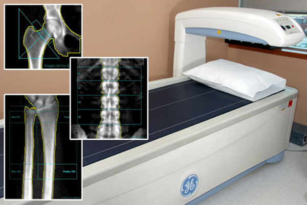 двухэнергетическая рентгеновская диагностика