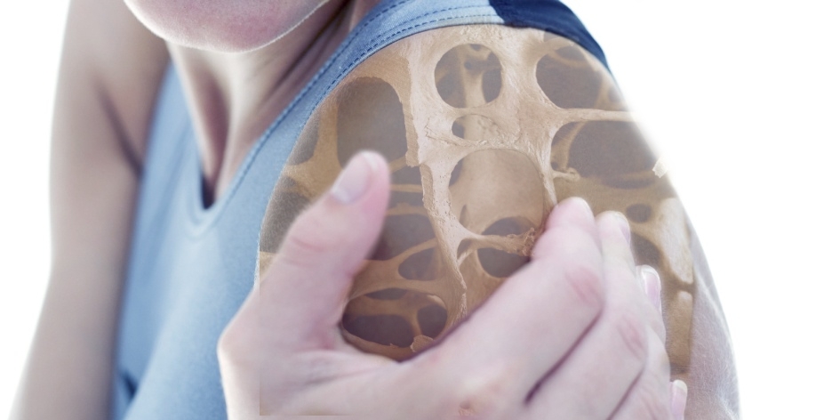 остеопороз плечевого сустава