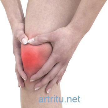 Диагностика артрит коленного сустава симптомы и лечение thumbnail