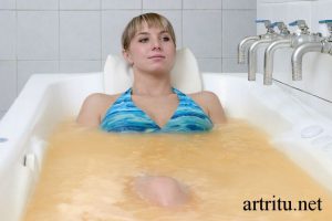При артрите радоновые или сероводородные ванны thumbnail