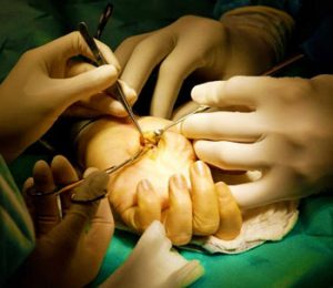 Классификация контрактур суставов и их лечение thumbnail