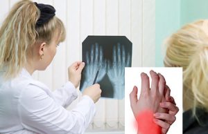Инфекционный артрит у детей причины thumbnail