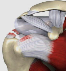 Травма манжеты плечевого сустава лечение thumbnail