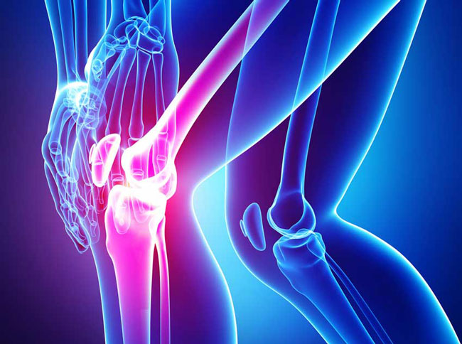 Какими препаратами лечить артрит коленного сустава thumbnail