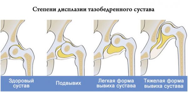 Тазобедренный сустав фото