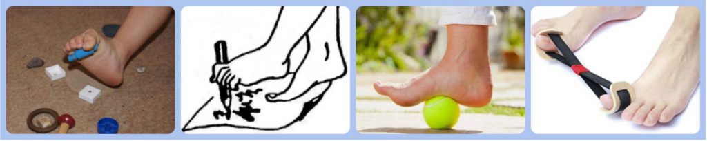 Пальцы ног искривляются лечение thumbnail