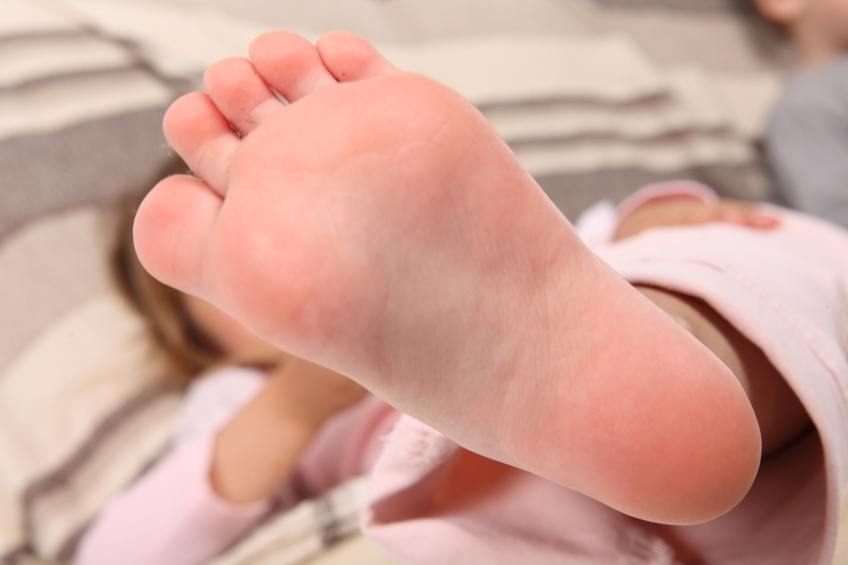 Шпоры на ногах у детей лечение thumbnail