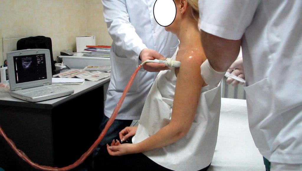 Изображение - Воспаление плечевого сустава чем лечить vospalenie-plechevogo-sustava-1024x581