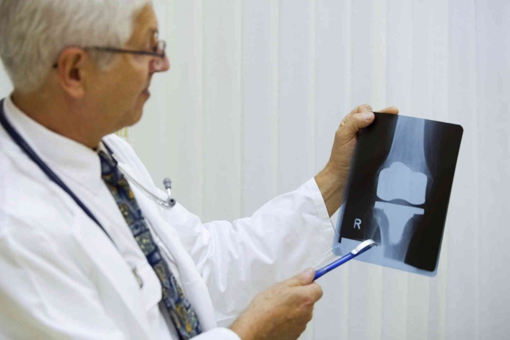 Артрит остеопороз коленного сустава thumbnail
